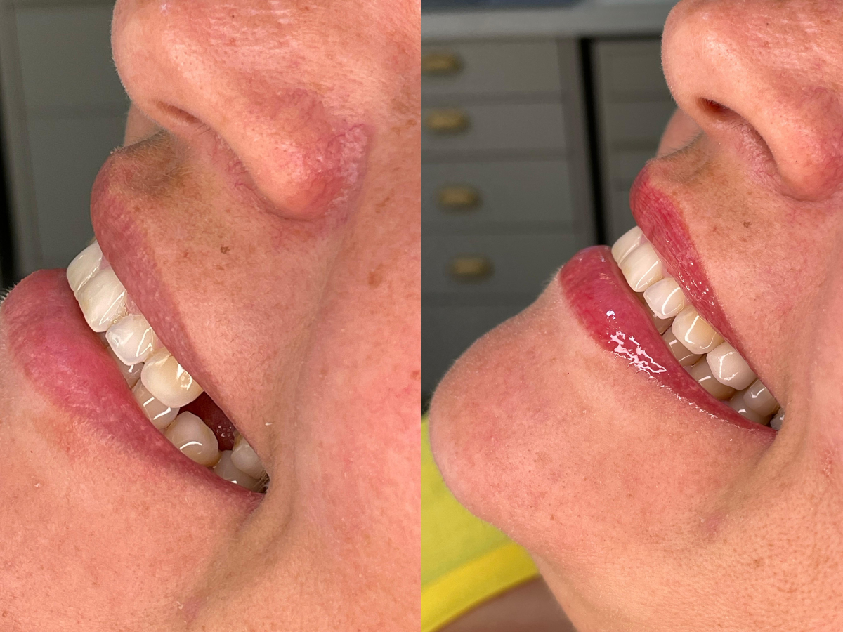 Implantes dentários: como funciona e por que vale a pena investir